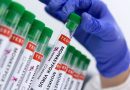 Rio Grande do Sul confirma quinto caso de varíola dos macacos
